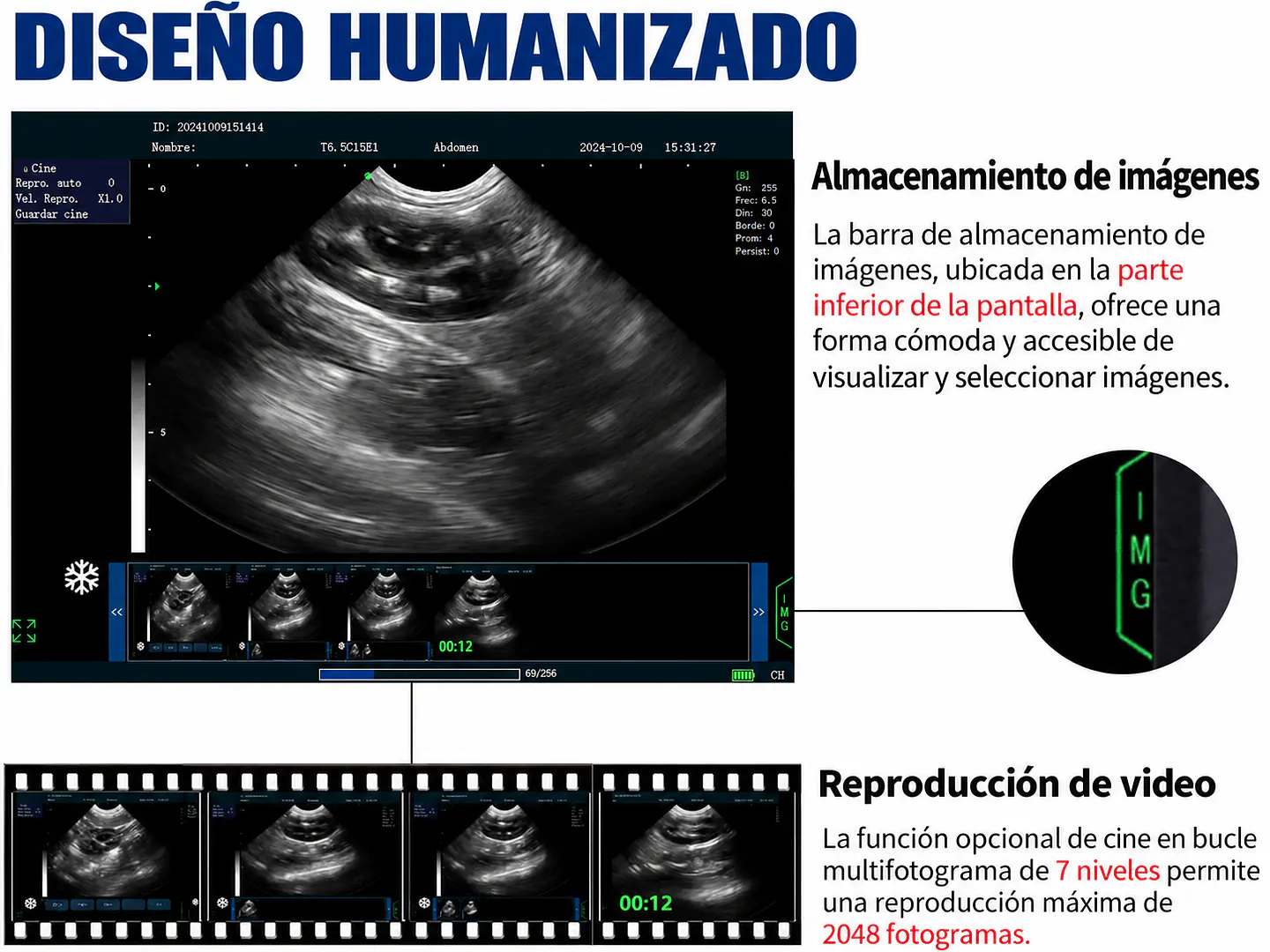 Ecografo Veterinario con transductor Macro convexo 4