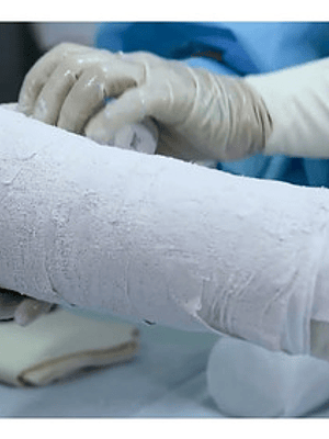 Venda De Yeso 5cmx 3m Yesoterapia Lesiones Moldes - 1 Unid