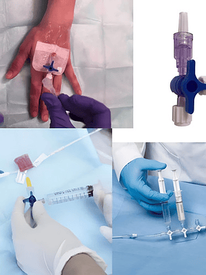 Caja 50 Unids Alargador Venoso Con Llave 3 Pasos 10cm