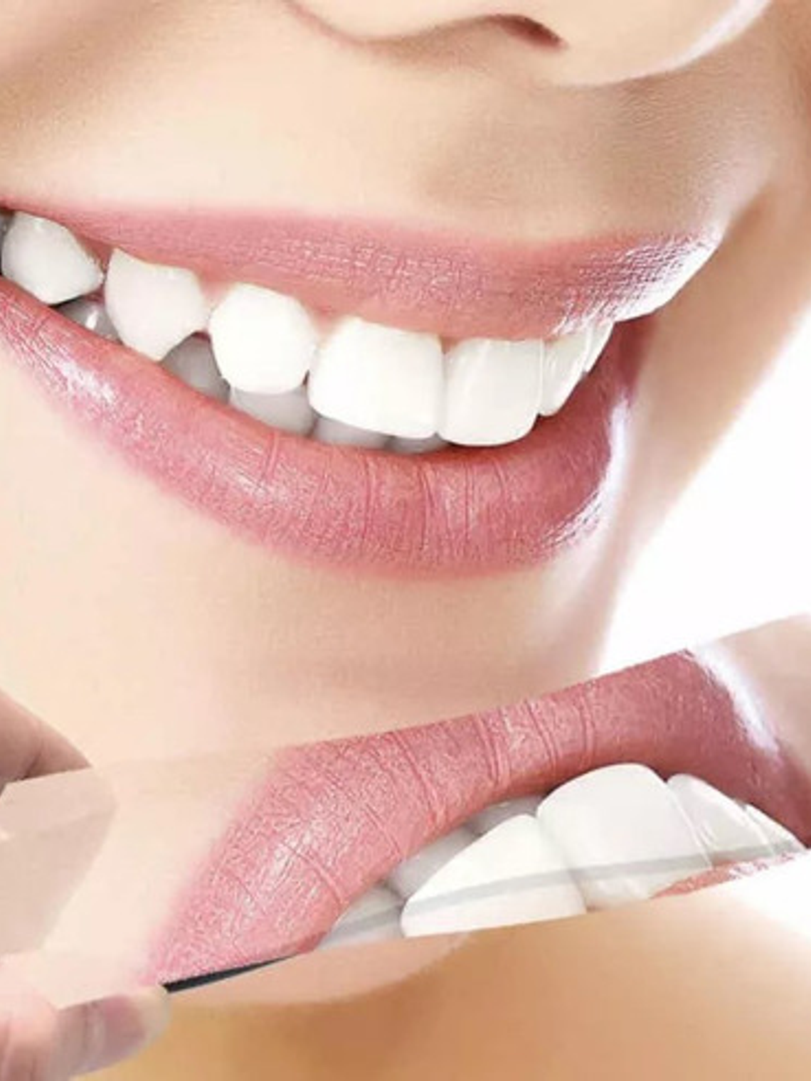 Set 5 Espejos Intraorales Fotografía Dental Para Ortodoncia 5