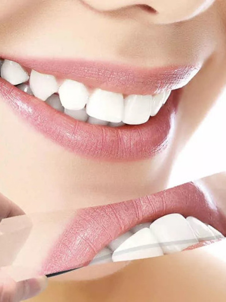 Set 5 Espejos Intraorales Fotografía Dental Para Ortodoncia 5