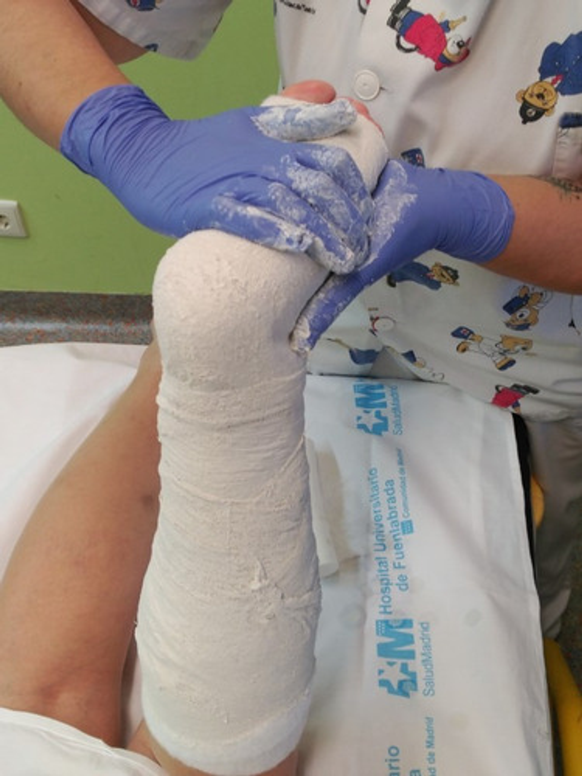 Venda De Yeso 7.5cmx 3m Yesoterapia Lesiones Moldes - 1 Unid 3