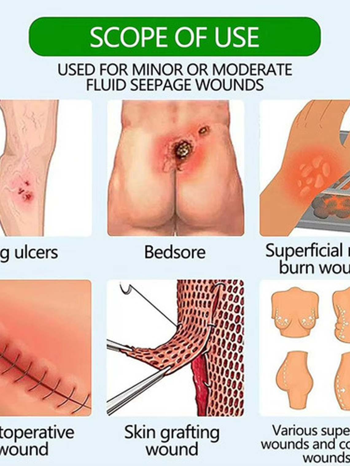 Parche Escaras Sacro Espuma Silicona 17,5x17,5 Cm Sacrum 1 U 4