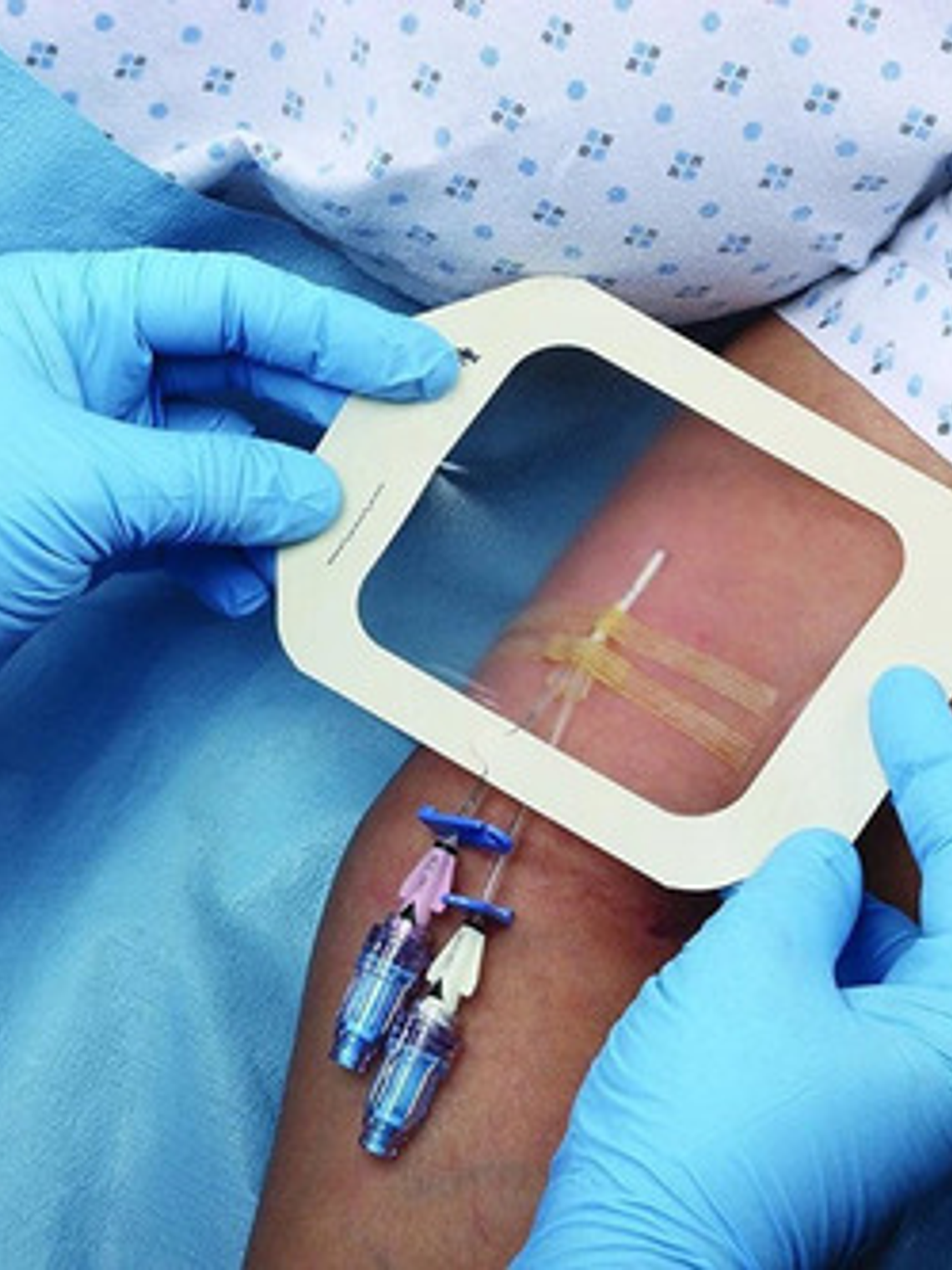 Tegaderm Film 3m 1626w Transparente  10x12 Cm Pack 10 Unids 4