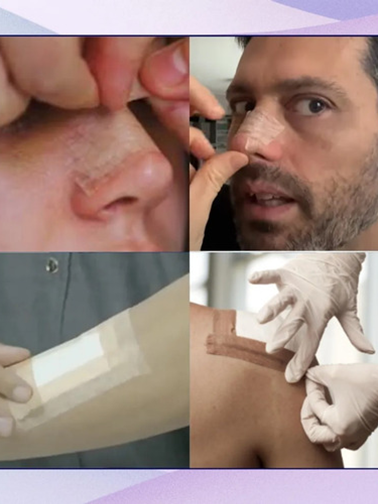 3m Tela Micropore 5cm X 9m Color Piel 1533-2 - 1 U 4