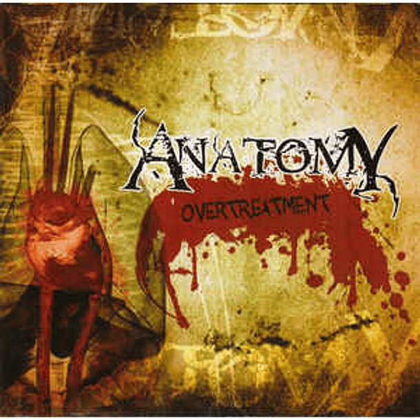 ANATOMY - Overtreatment CD