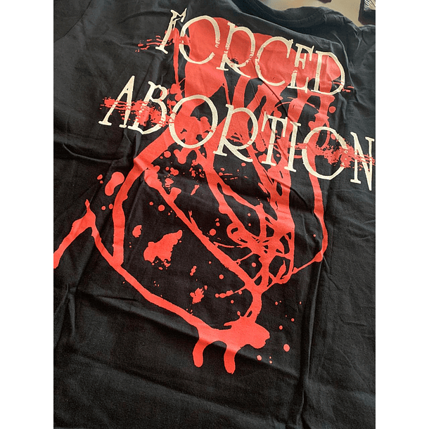 INJURY DEEPEN - Forced Abortion SHIRT L / 2XL
