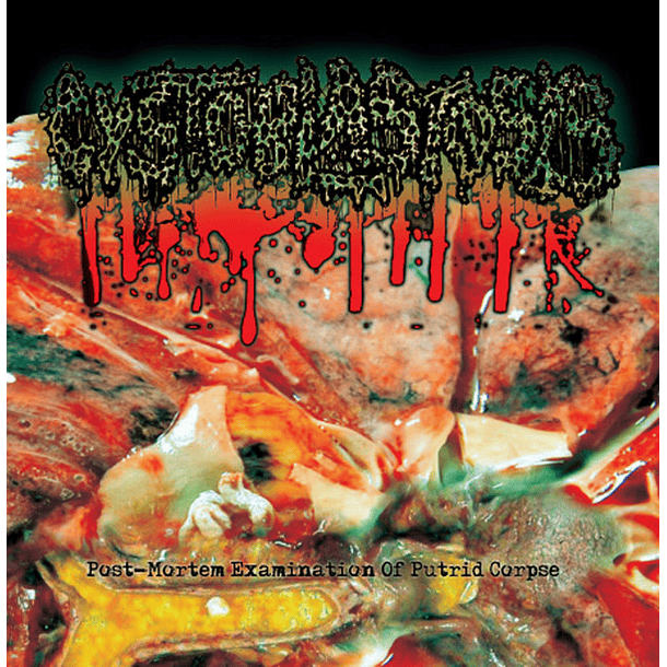 CYSTOBLASTOSIS -  Post-Mortem Examination Of Putrid Corpse CD