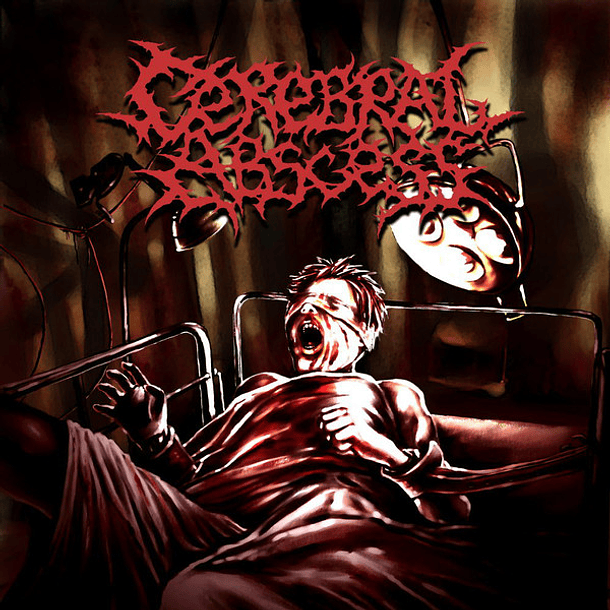 CEREBRAL ABSCESS - S/t CD