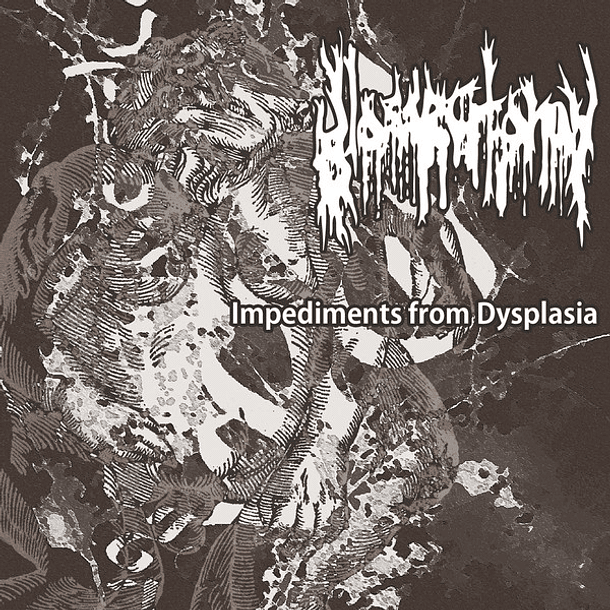 GLOSSECTOMY - Impediments From Dysplasia CD