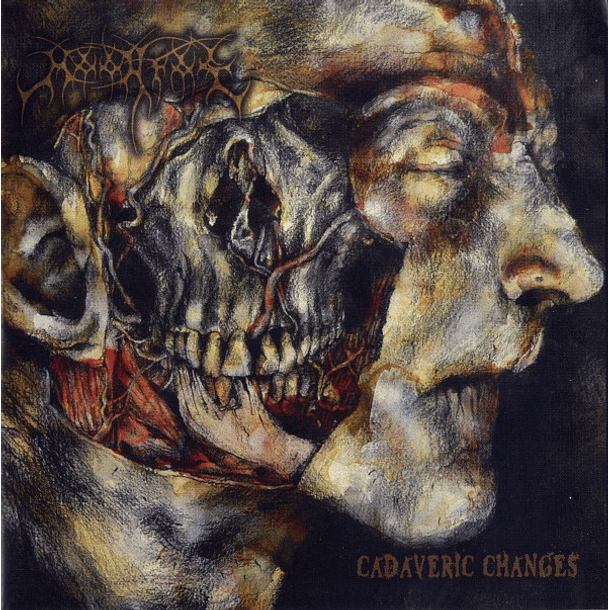 MOONFOG - Cadaveric Changes CD