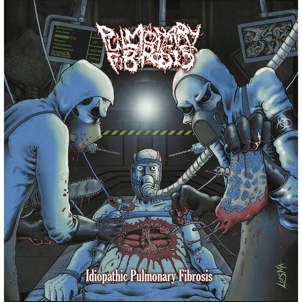 PULMONARY FIBROSIS -  Idiopathic Pulmonary Fibrosis CD