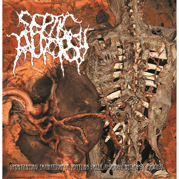 SEPTIC AUTOPSY -  Spontaneous Emanation Of Rotting Smell Through Necropsy Process CD