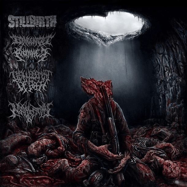 STILLBIRTH / CONGENITAL ANOMALIES / DISFIGUREMENT OF FLESH / NEPHRECTOMY - Pathology Of Anomalous Origin 4 WAY SPLIT CD