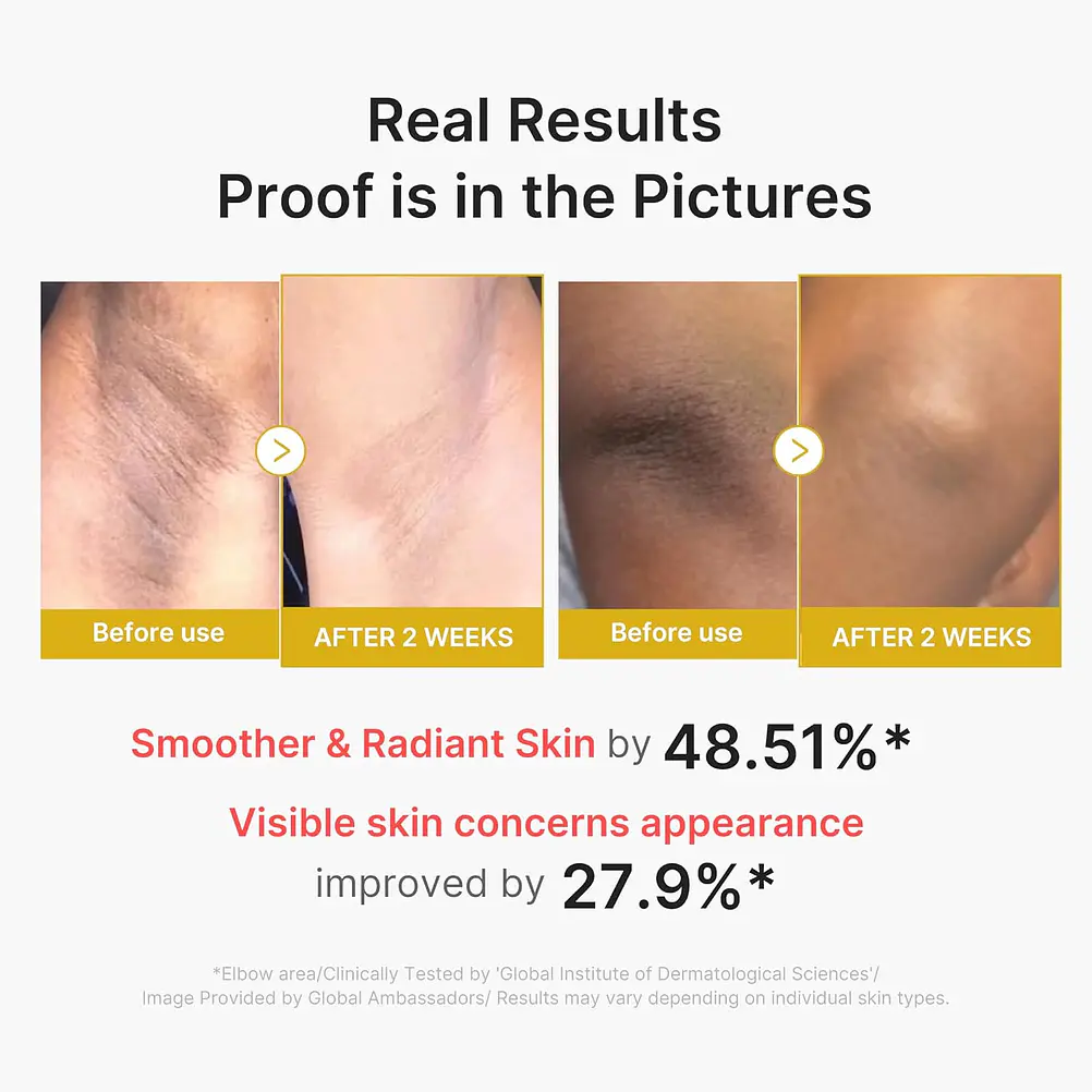 MEDICUBE Kojic Body Peel Shot – Exfoliante Despigmentante Corporal 2