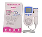 Detector Fetal Doméstico JSL-T501 Color Rosa – Escucha el Latido del Bebé (No Diagnóstico) - Miniatura 3