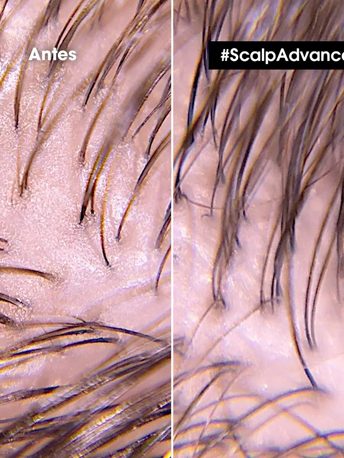 SHAMPOO DENSIFICADOR SERIOXLY 300ML 2