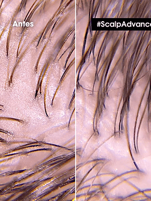 SHAMPOO DENSIFICADOR SERIOXLY 300ML