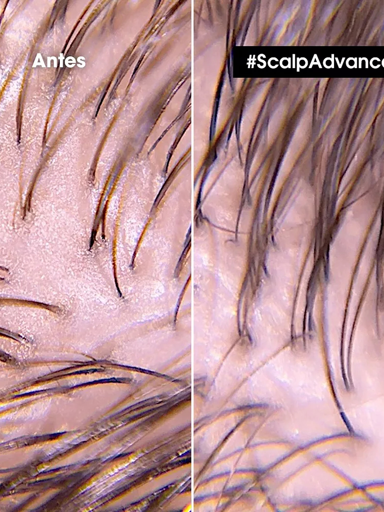 SHAMPOO DENSIFICADOR SERIOXLY 300ML 2