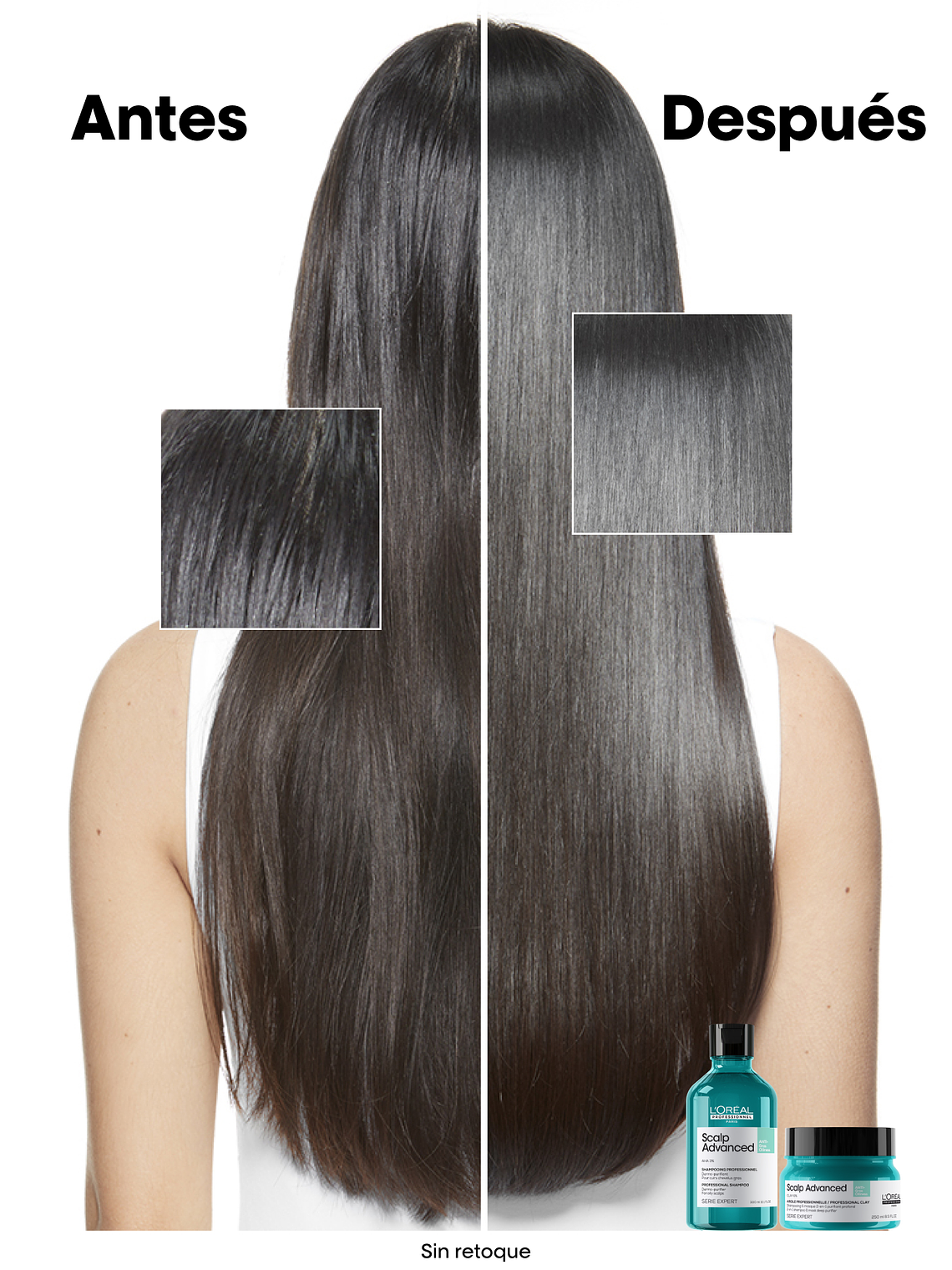 SHAMPOO ANTI GRASA SCALP ADVANCED 300ML 4