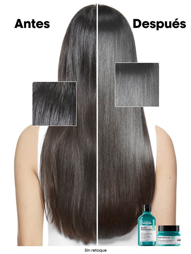 SHAMPOO ANTI GRASA SCALP ADVANCED 300ML 4