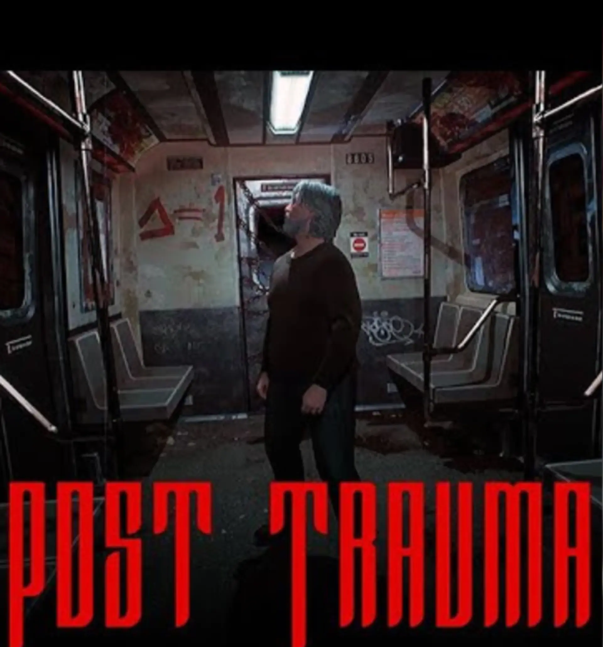 Post trauma Xbox Series S / X 1