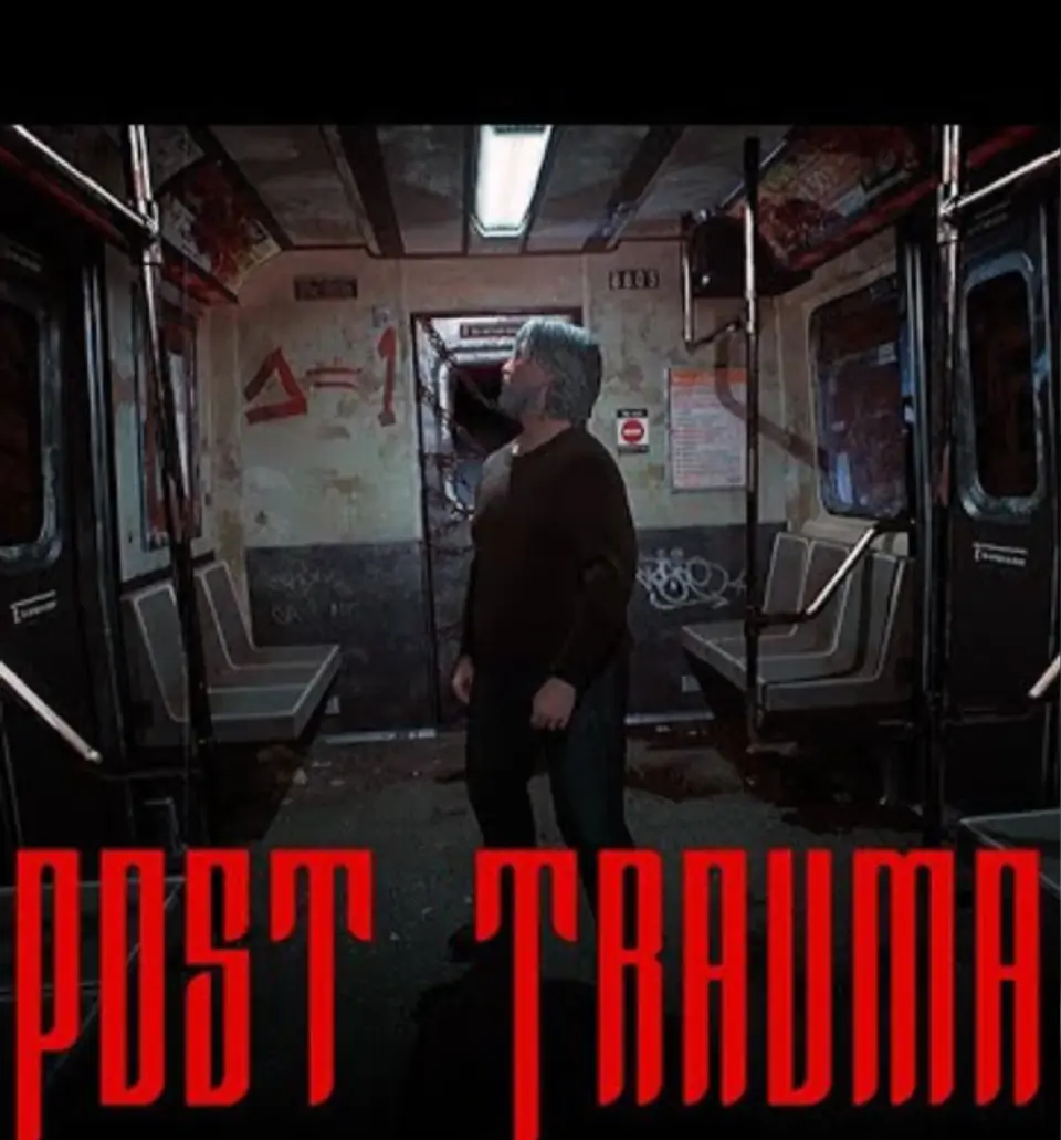Post trauma Xbox Series S / X 1