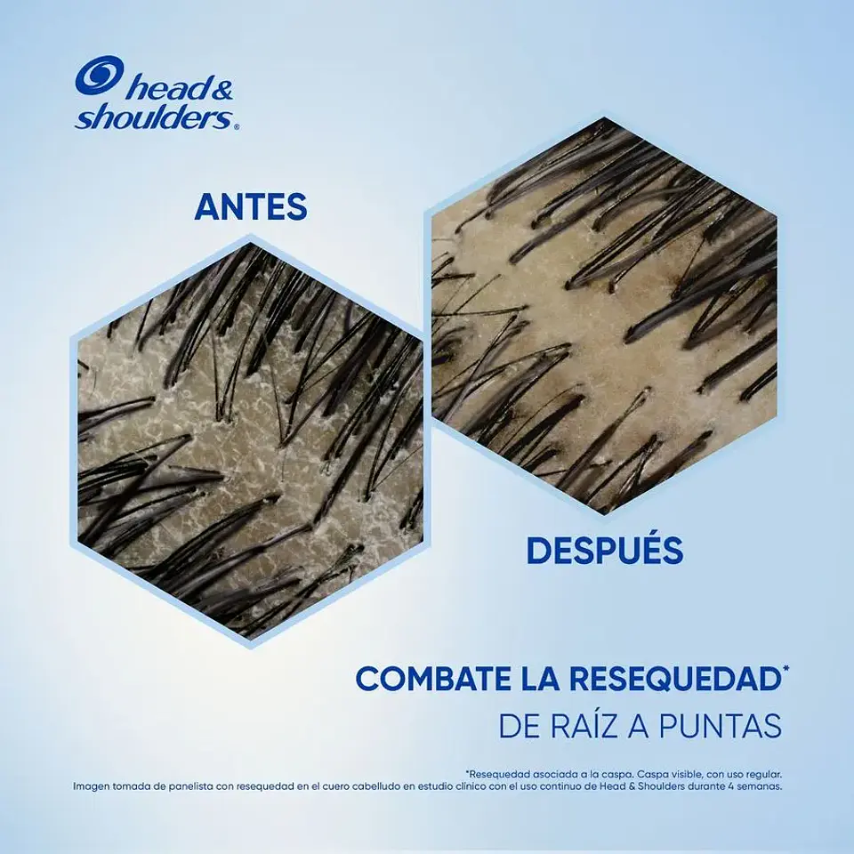 Shampoo Head & Shoulders Anti-Resequedad 1 L 5