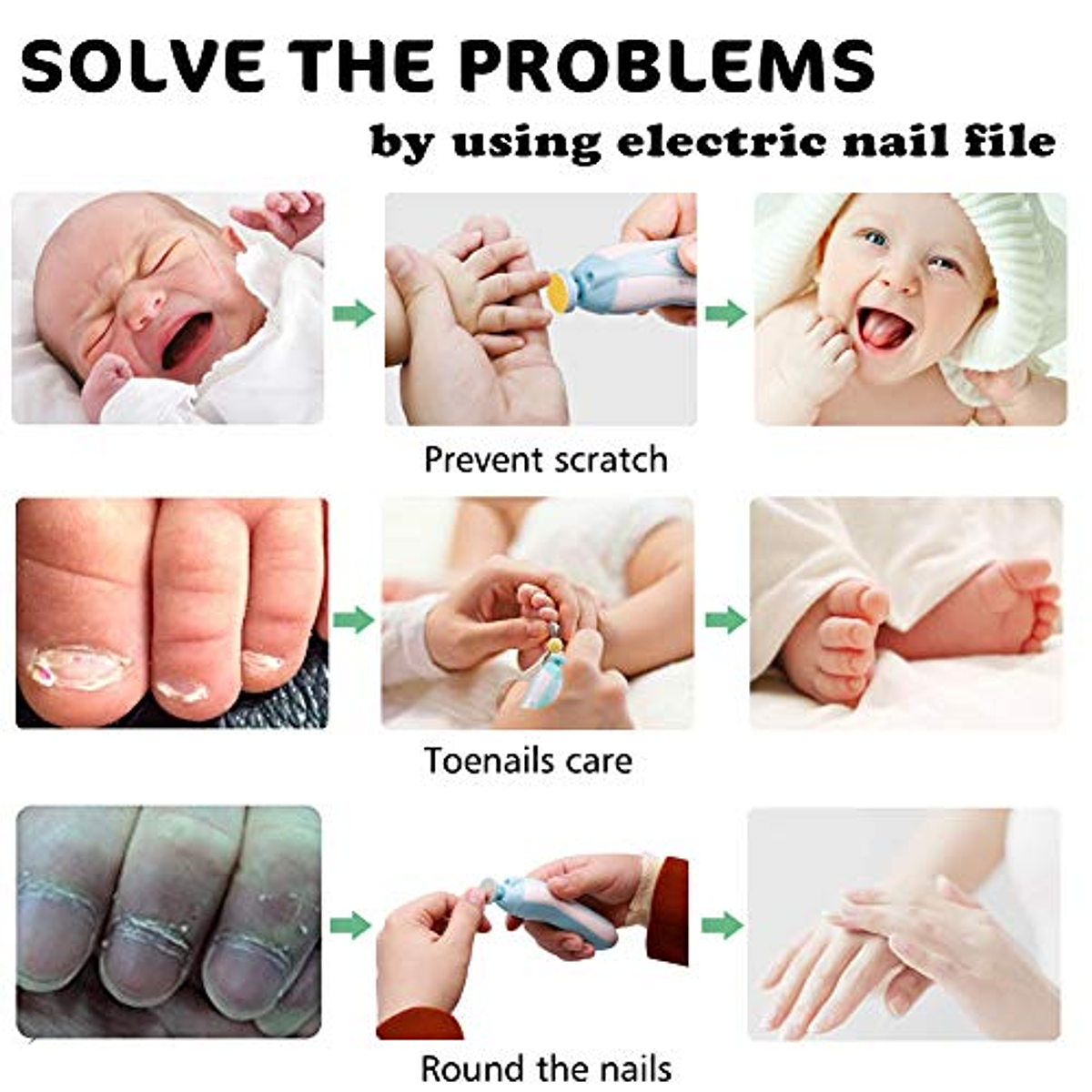 Kit eléctrico para cortar, limar y pulir las uñas de tu bebé - Uniradio  Informa