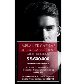 IMPLANTE CAPILAR Cuero Cabelludo - 4.000 Folículos