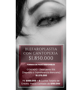 BLEFAROPLASTIA SUPERIOR CON CANTOPEXIA anestesia local