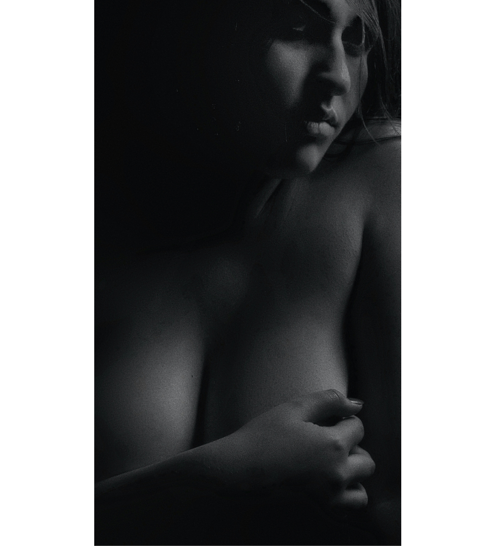 AUMENTO + LEVANTAMIENTO MAMARIO 360º | con Implantes de Silicona