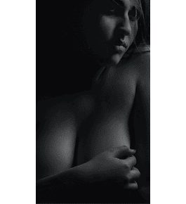 AUMENTO MAMARIO & LEVANTAMIENTO 360º | con Implantes de Silicona