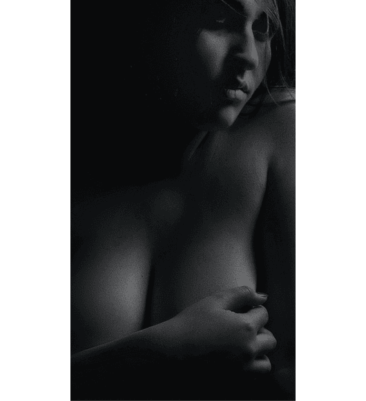 AUMENTO + LEVANTAMIENTO MAMARIO 360º | con Implantes de Silicona