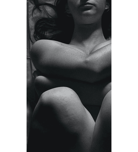 AUMENTO + LEVANTAMIENTO MAMARIO EN "T" INVERTIDA | con Implantes de Silicona