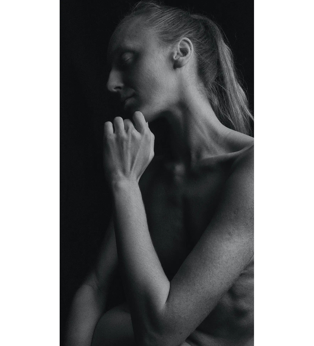 LEVANTAMIENTO MAMARIO EN 