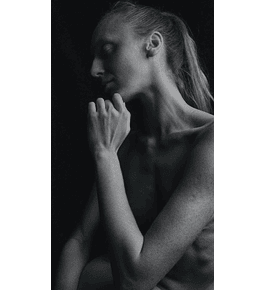 PEXIA "T" INVERTIDA - sin implantes