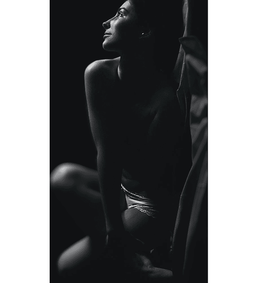 EXPLANTACION MAMARIA