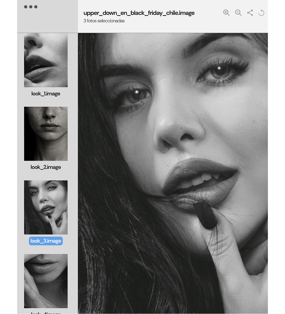 UPPER & DOWN LIP LIFT | anestesia local