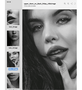 UPPER & DOWN LIP LIFT | anestesia local