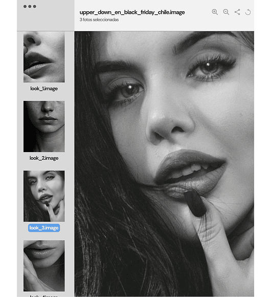 UPPER & DOWN LIP LIFT | anestesia local