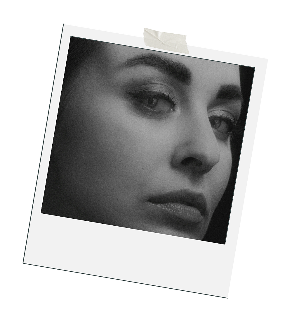 MINILIFTING | anestesia local