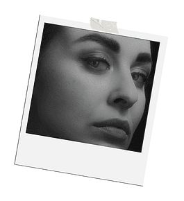 MINILIFTING | anestesia local