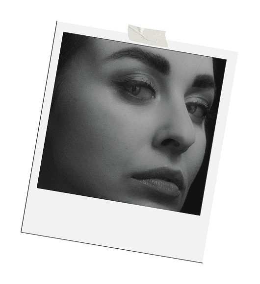 MINILIFTING | anestesia local