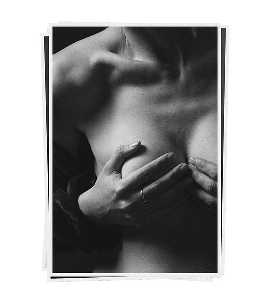 AUMENTO MAMARIO | con implantes de silicona