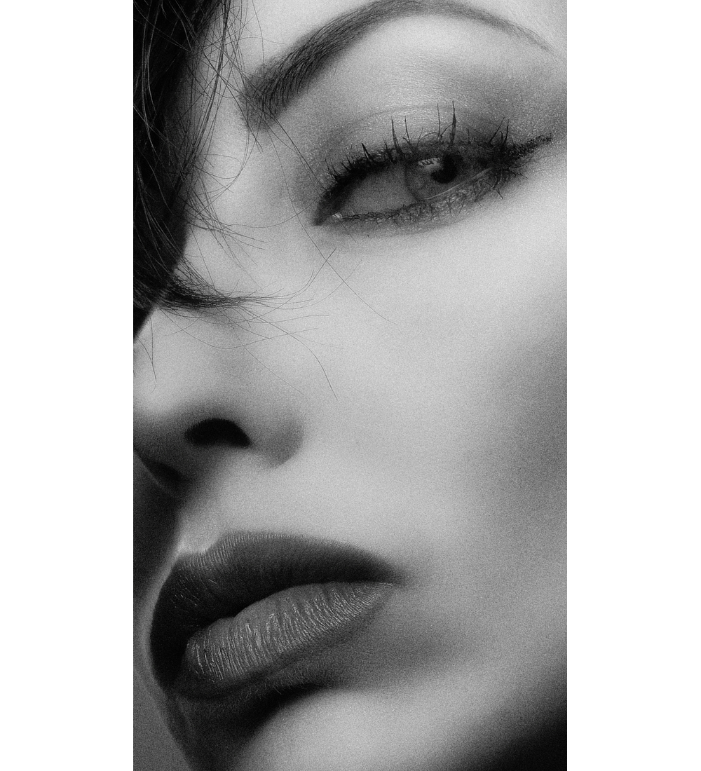 BLEFAROPLASTIA SUPERIOR