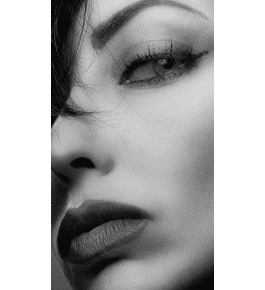 BLEFAROPLASTIA SUPERIOR