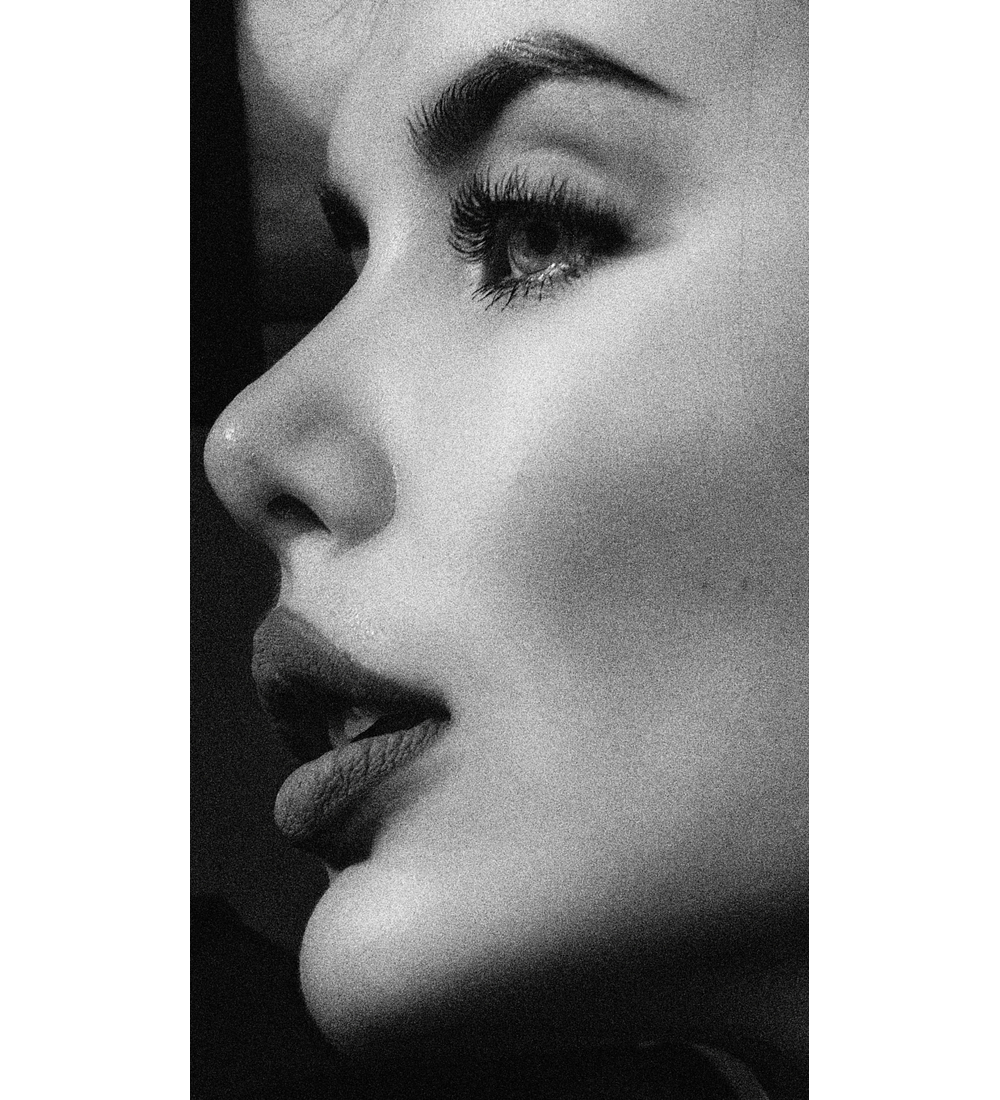 ELEVACIÓN PUNTA NASAL