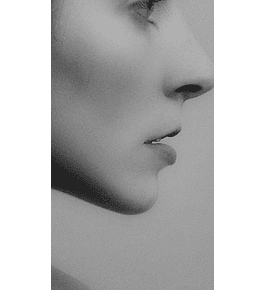 UPPER LIP LIFT + CIERRE ALAR