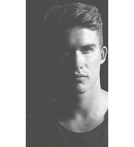 IMPLANTE CAPILAR Cuero Cabelludo - 1.000 Folículos